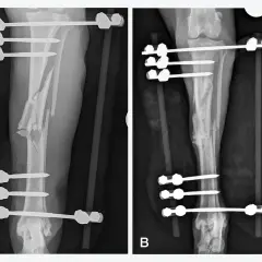 Radiografie di un cane con frattura complessa della tibia, con fissatore esterno. Immagine A mostra la frattura iniziale, B il recupero. Tempi di recupero variabili.