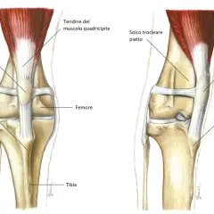 Illustrazione anatomica del ginocchio di un cane, che mostra la rotula e il femore. A destra, la lussazione mediale della rotula, una condizione che può richiedere un intervento chirurgico. Il costo dell'intervento per la lussazione rotula cane varia.