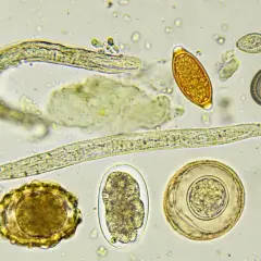 Vermi nei cani: uova e larve di parassiti intestinali osservate al microscopio.