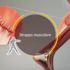 Dettaglio anatomico di uno strappo muscolare, con suture visibili. I sintomi di uno strappo muscolare nel cane possono includere zoppia e dolore.