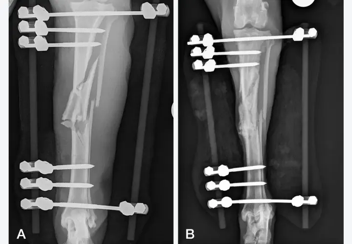 Radiografie di un cane con frattura complessa della tibia, con fissatore esterno. Immagine A mostra la frattura iniziale, B il recupero. Tempi di recupero variabili.