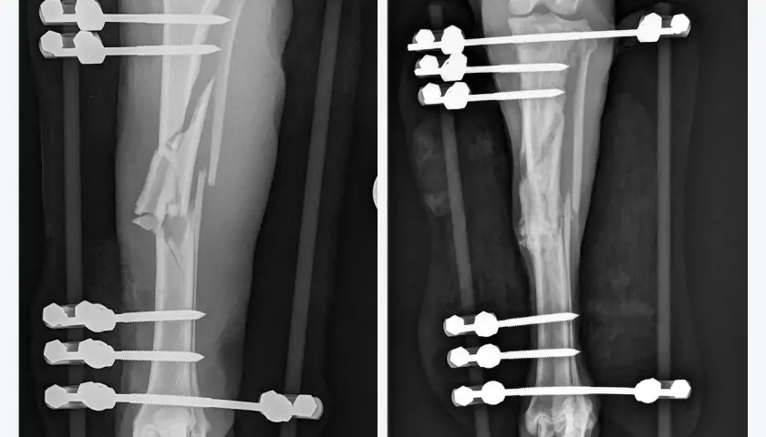 Radiografie di un cane con frattura complessa della tibia, con fissatore esterno. Immagine A mostra la frattura iniziale, B il recupero. Tempi di recupero variabili.