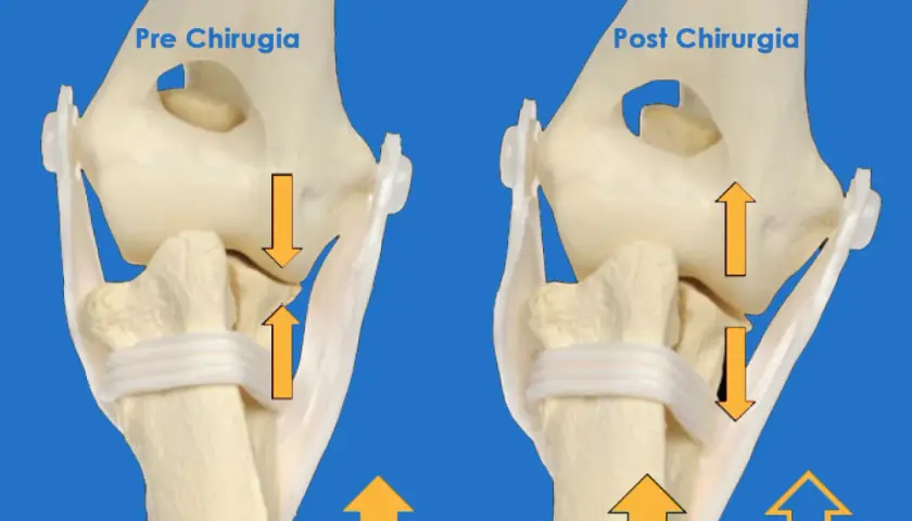 Modello anatomico del gomito di un cane: a sinistra, prima dell'intervento per una lussazione; a destra, dopo l'intervento.