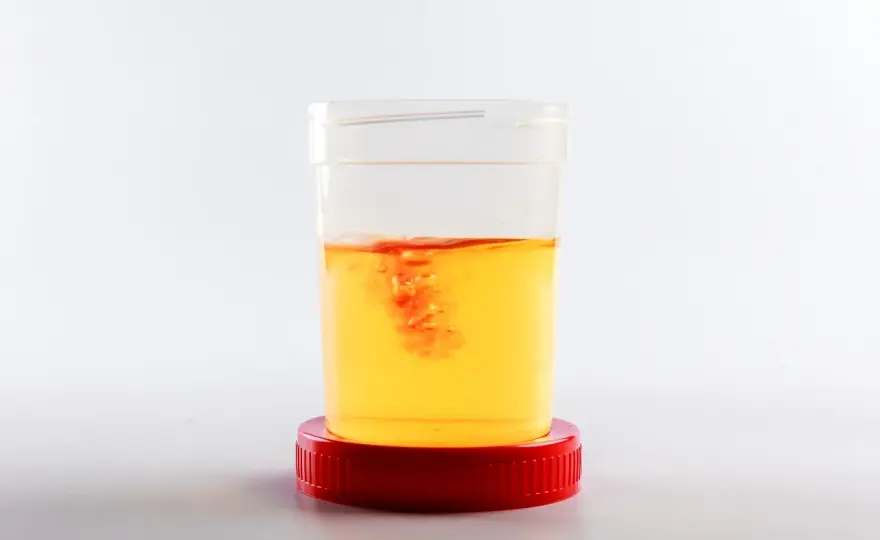 Sangue nelle urine del cane - Quando è davvero urgente?