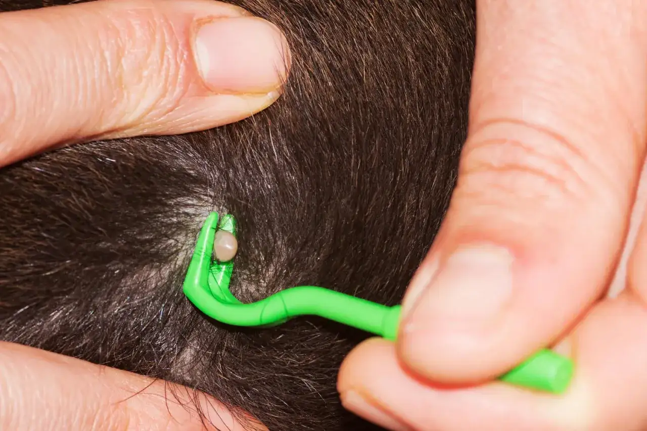 Rimozione di una zecca con un apposito strumento. Un rimedio naturale come l'aceto contro le zecche pu&ograve; essere utile per prevenirle.