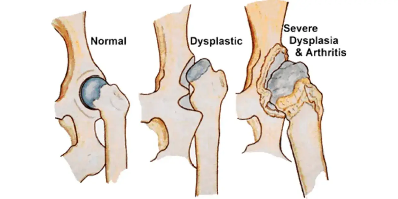 Illustrazione comparativa di anca di cane: normale, displastica e con grave displasia e artrite. La postura del cane &egrave; influenzata da queste condizioni.